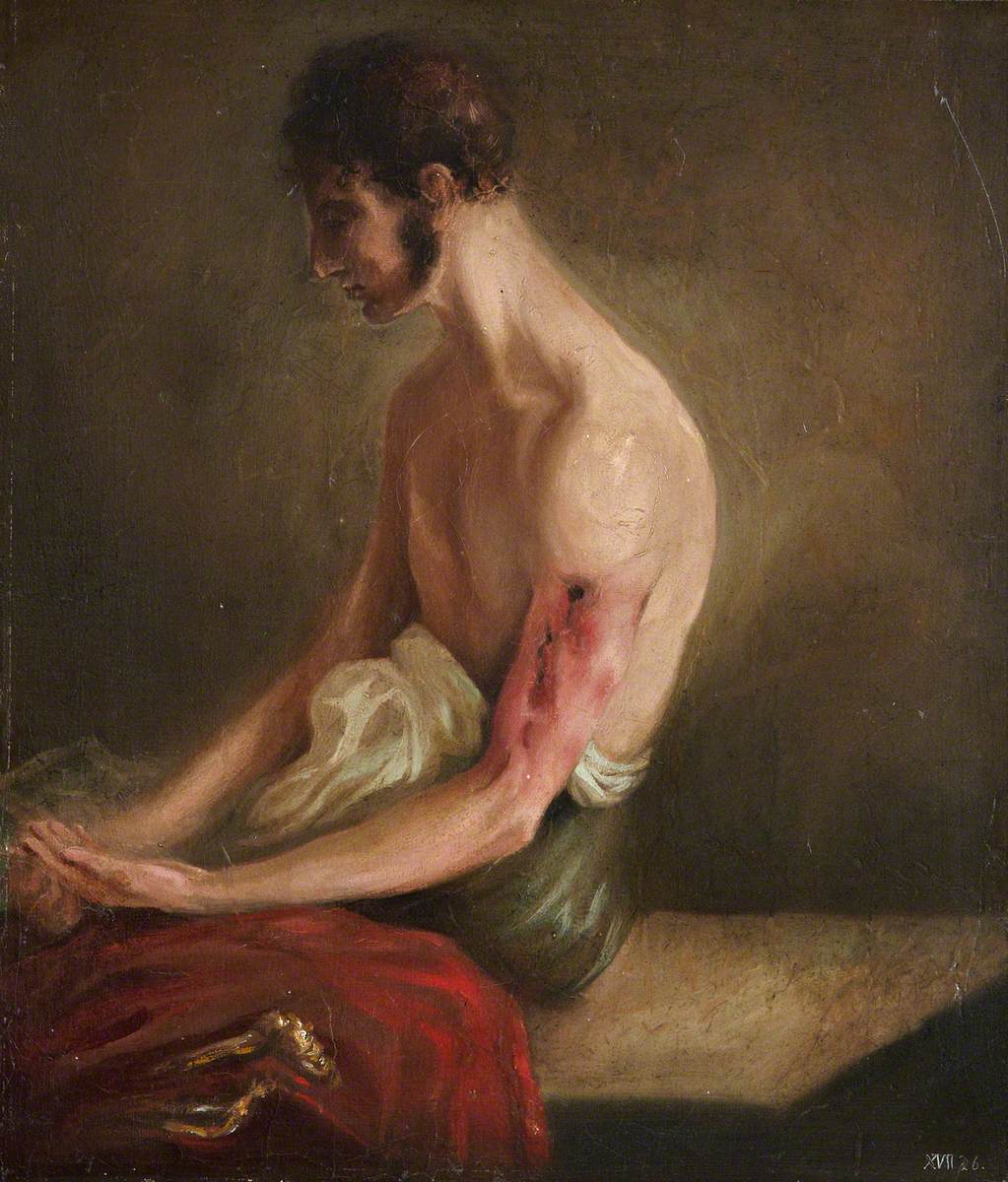 The Wounded following the Battle of Corunna: Gunshot Fracture of Shaft of Humerus by Charles Bell
