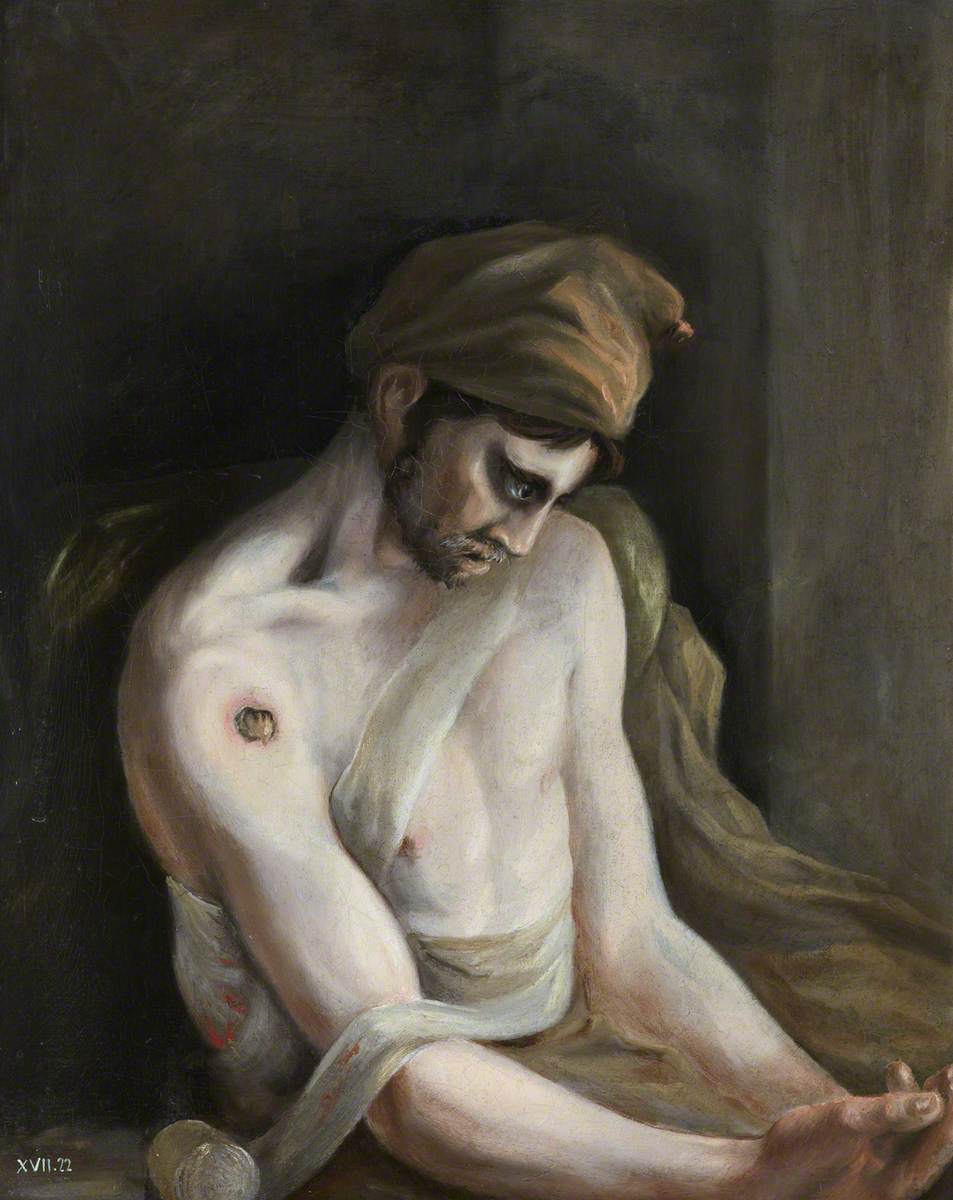 The Wounded following the Battle of Corunna: Gunshot Wound of Humerus by Charles Bell