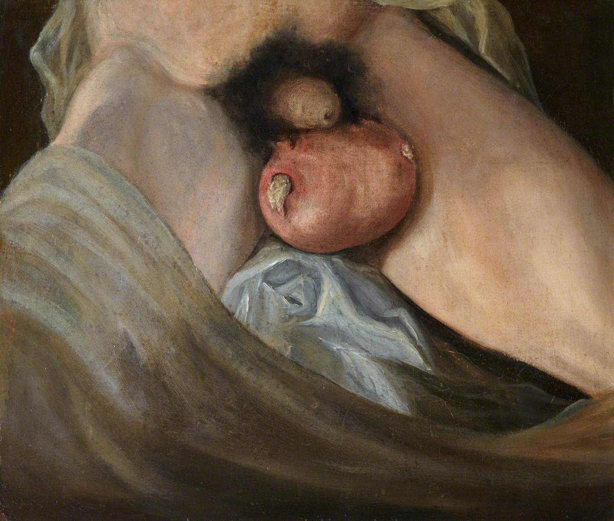 The Wounded following the Battle of Corunna: Gunshot Wound of Testes by Charles Bell