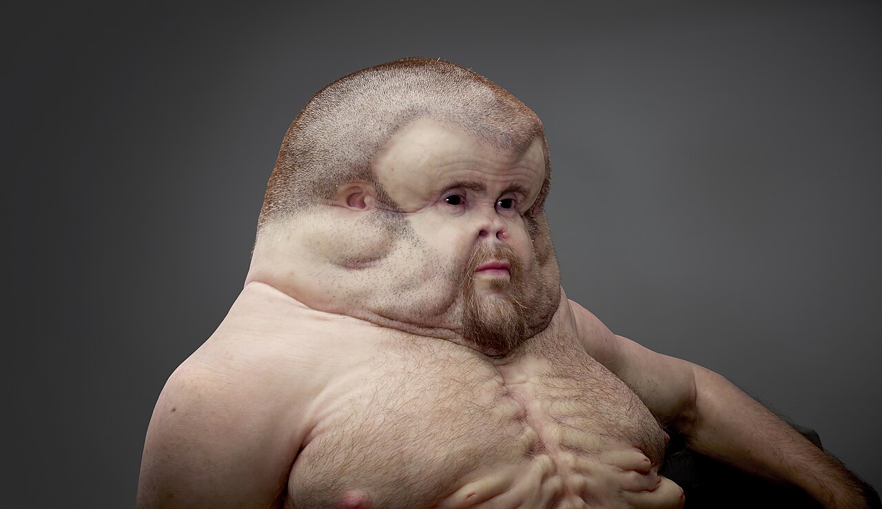Project Graham by Patricia Piccinini